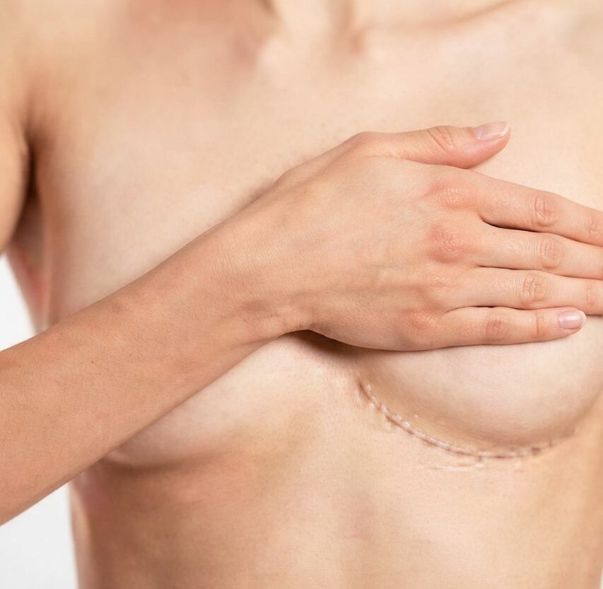 cirugia-oncologica